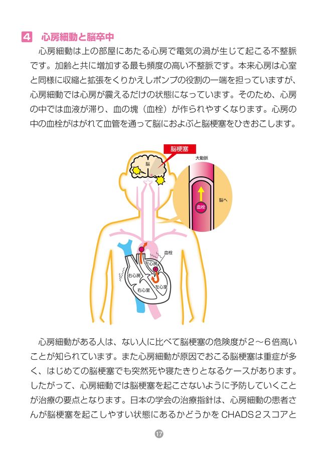 体内静電気を抜けば病気は怖くない! 体内静電気を抜けば病気は怖くない! | 堀 泰典 |本 | 通販 | Amazon