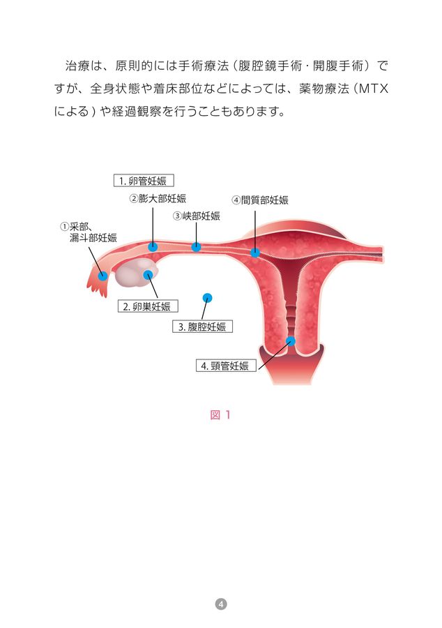 手術を要する産婦人科救急 こんなときどうする? 手術を要する産婦人科救急−こんなときどうする？ (OGS NOW 22